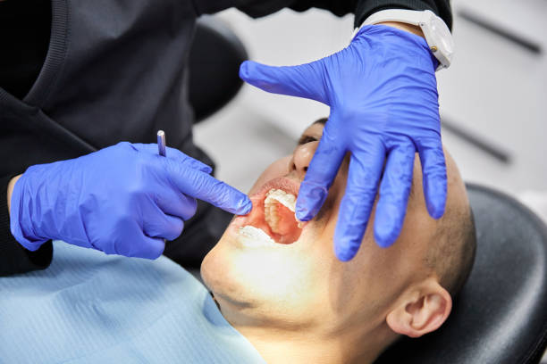 Best Emergency Treatment for Dental Infections or Abscesses in Sierra View, PA