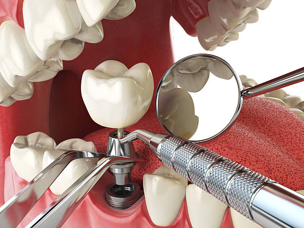 Best Emergency Dental Care for Broken or Chipped Teeth in Sierra View, PA